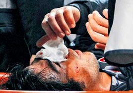 Toraman varsa korkma