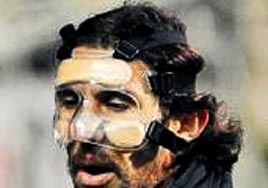 R��t� maskesiz oynad�